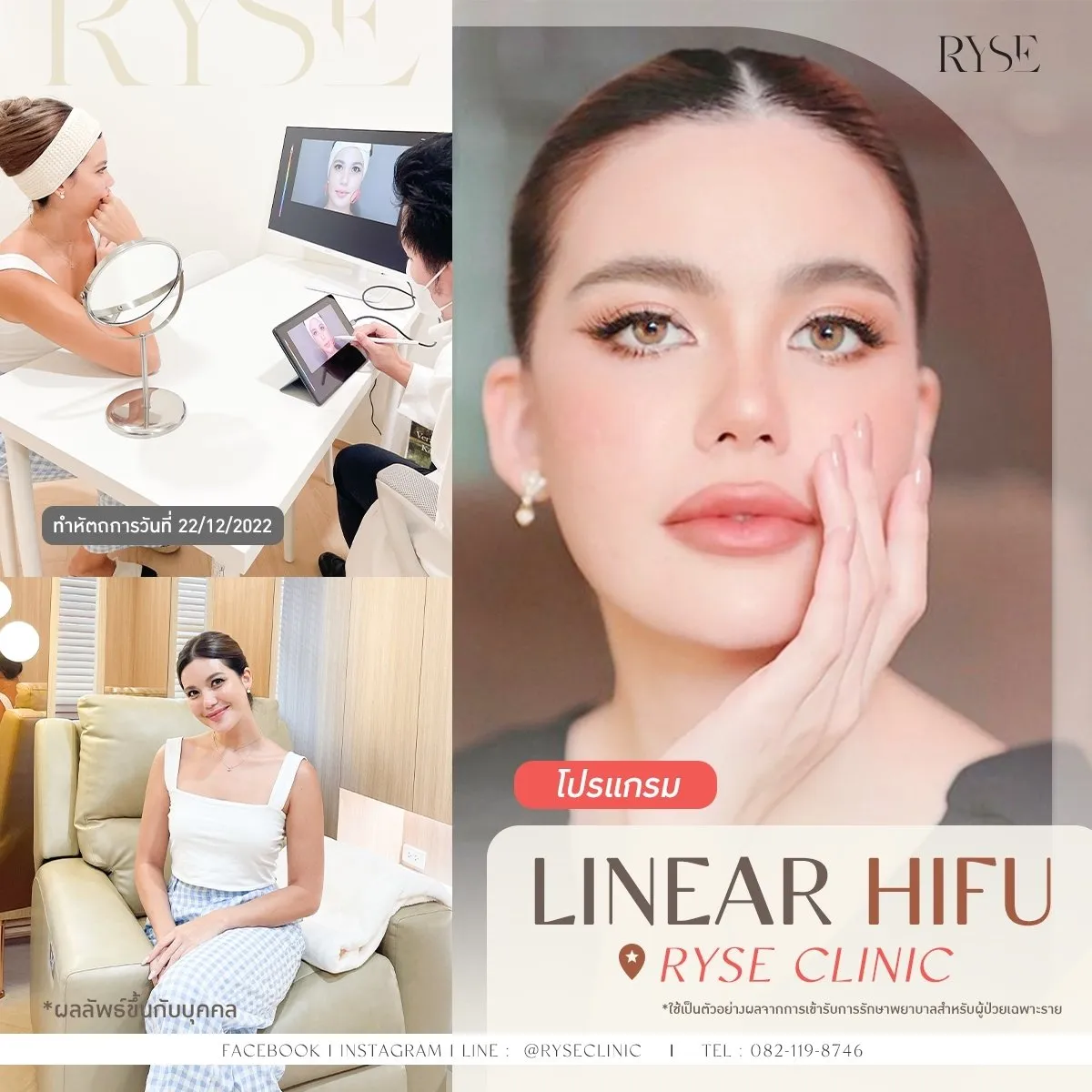 LINE_ALBUM_Ryse-Clinic_240902_3